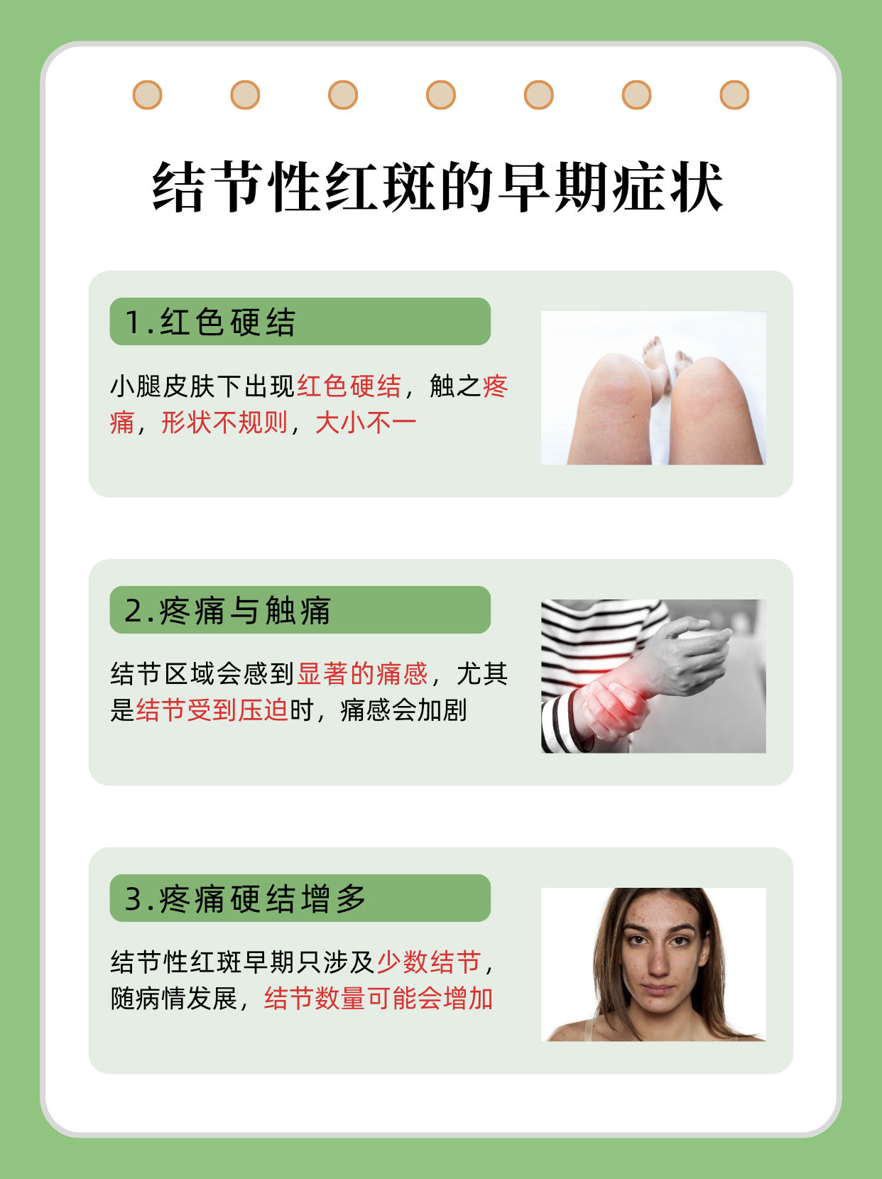 结节性红斑是一种主要影响下肢的炎症性皮肤病,其特征是皮肤上出现