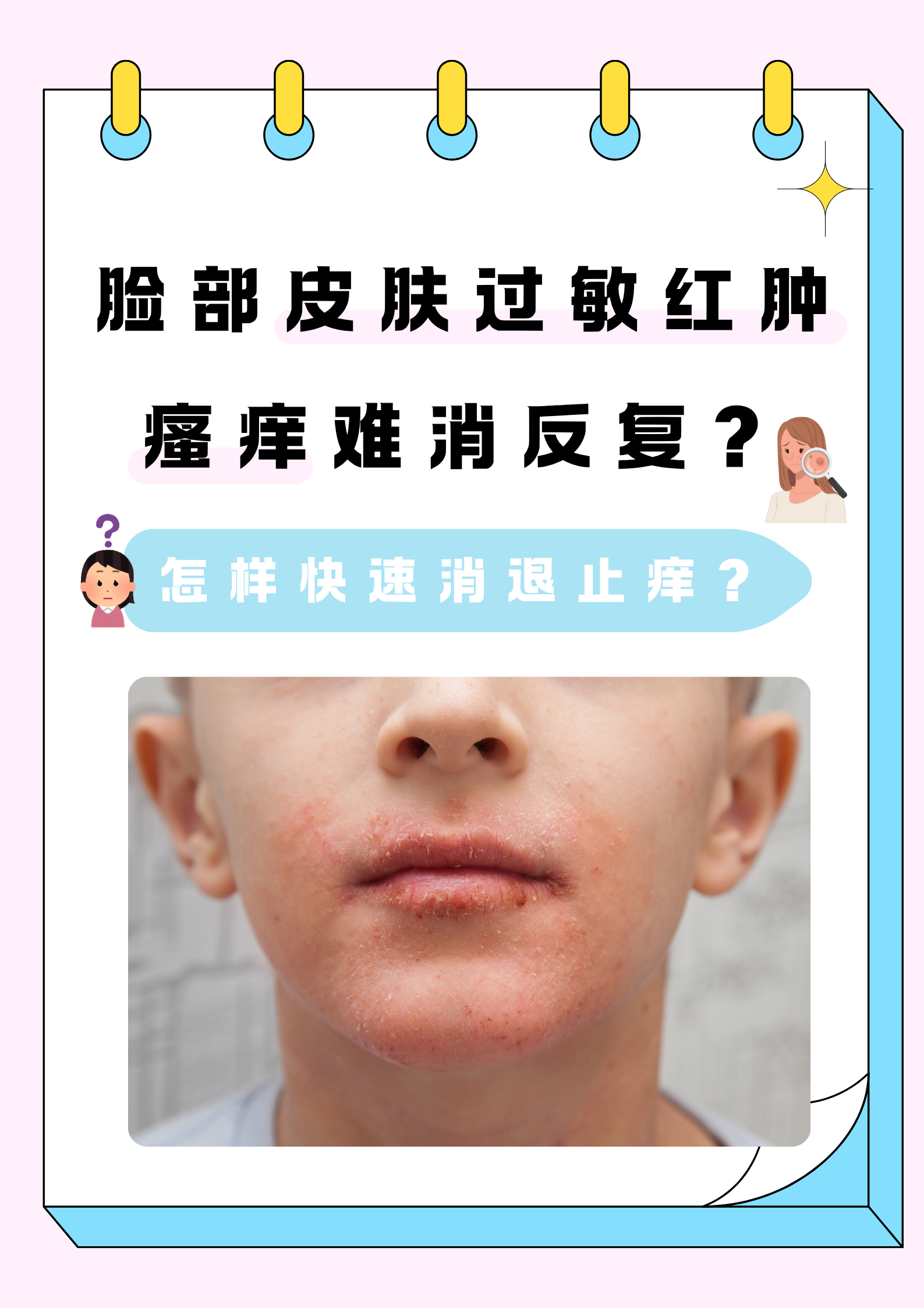 脸部皮肤过敏红肿瘙痒反复困扰着不少人,不仅影响颜值,更让人坐立