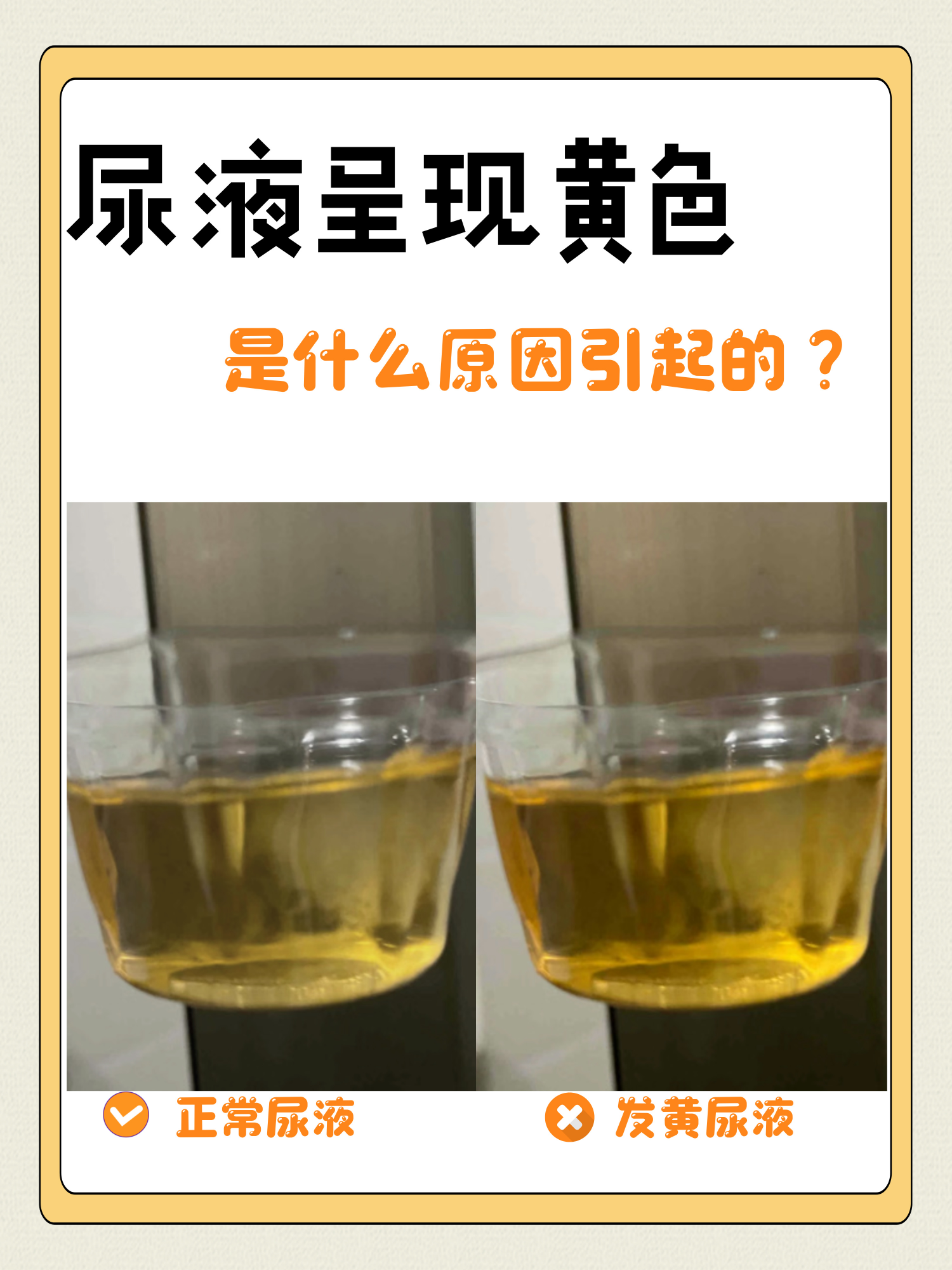 尿液呈现黄色正常尿液是什么颜色正常尿液颜色尿液颜色正常尿液的颜色