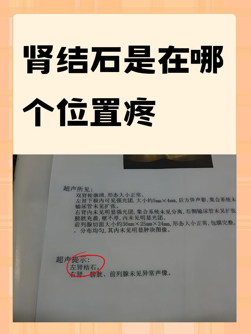 肾痛位置图图片图片