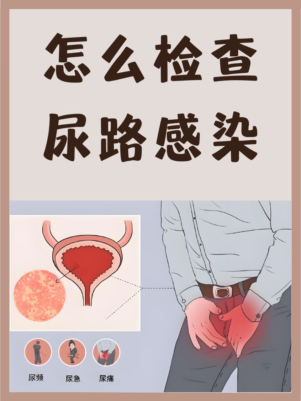 如何有效治疗前列腺炎？患者刘先生的治疗故事