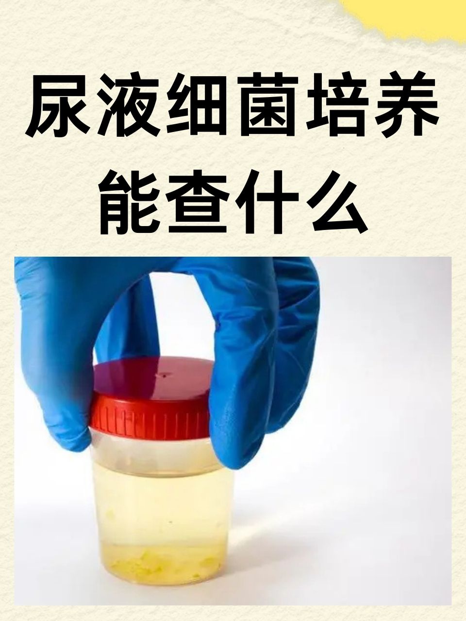 前列腺液细菌培养图片