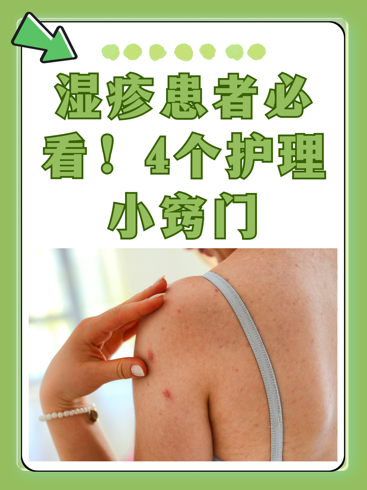 李茂发治疗皮肤湿疹方法(李茂发一病一方治疗阴道干涩)