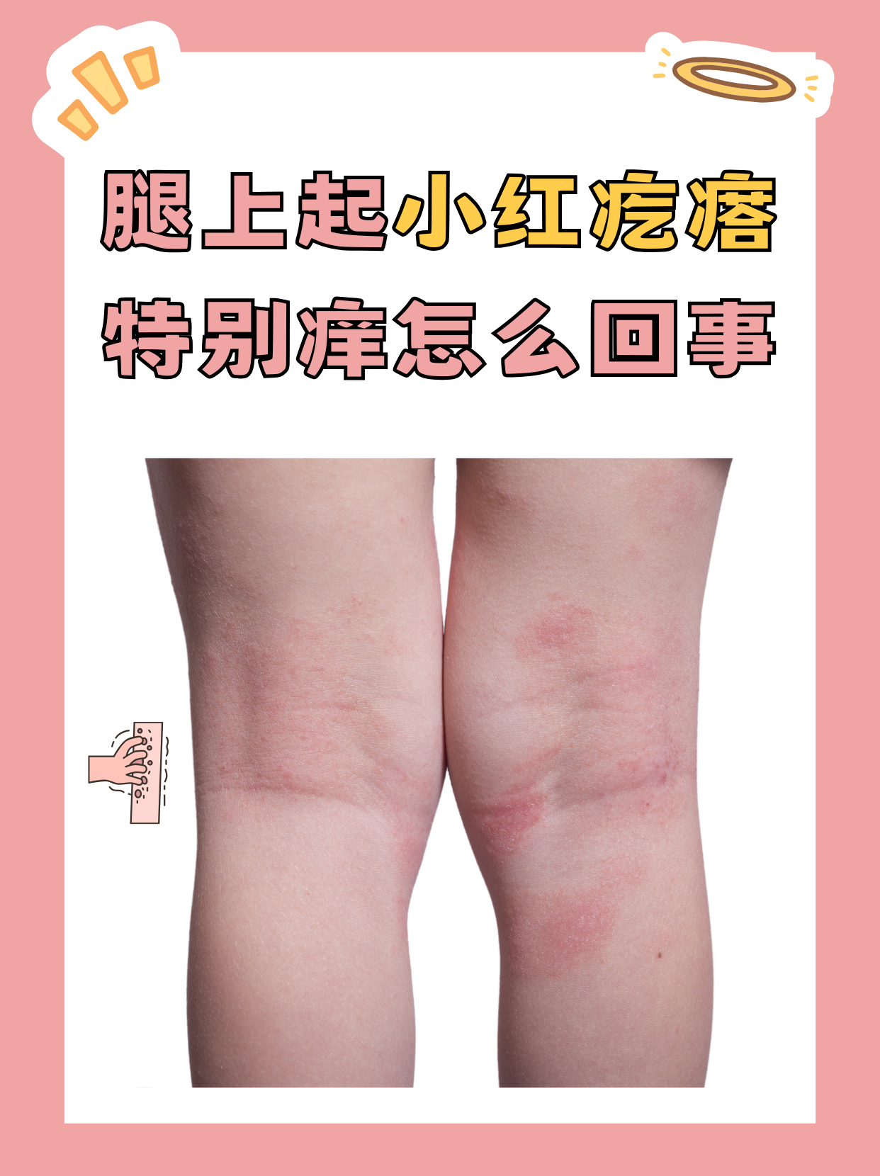 为什么身上很痒