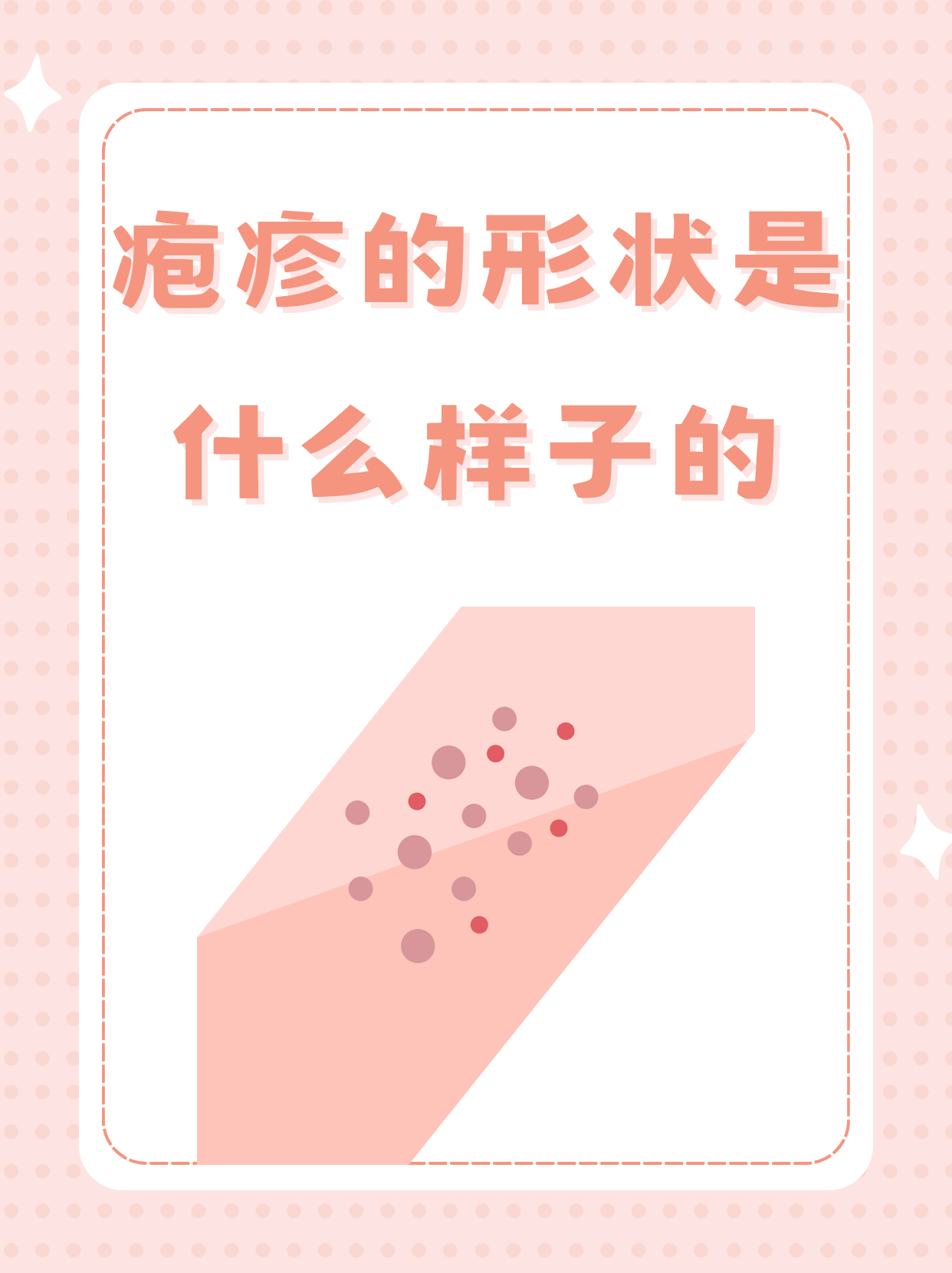 为什么长疱疹 为什么长疱疹