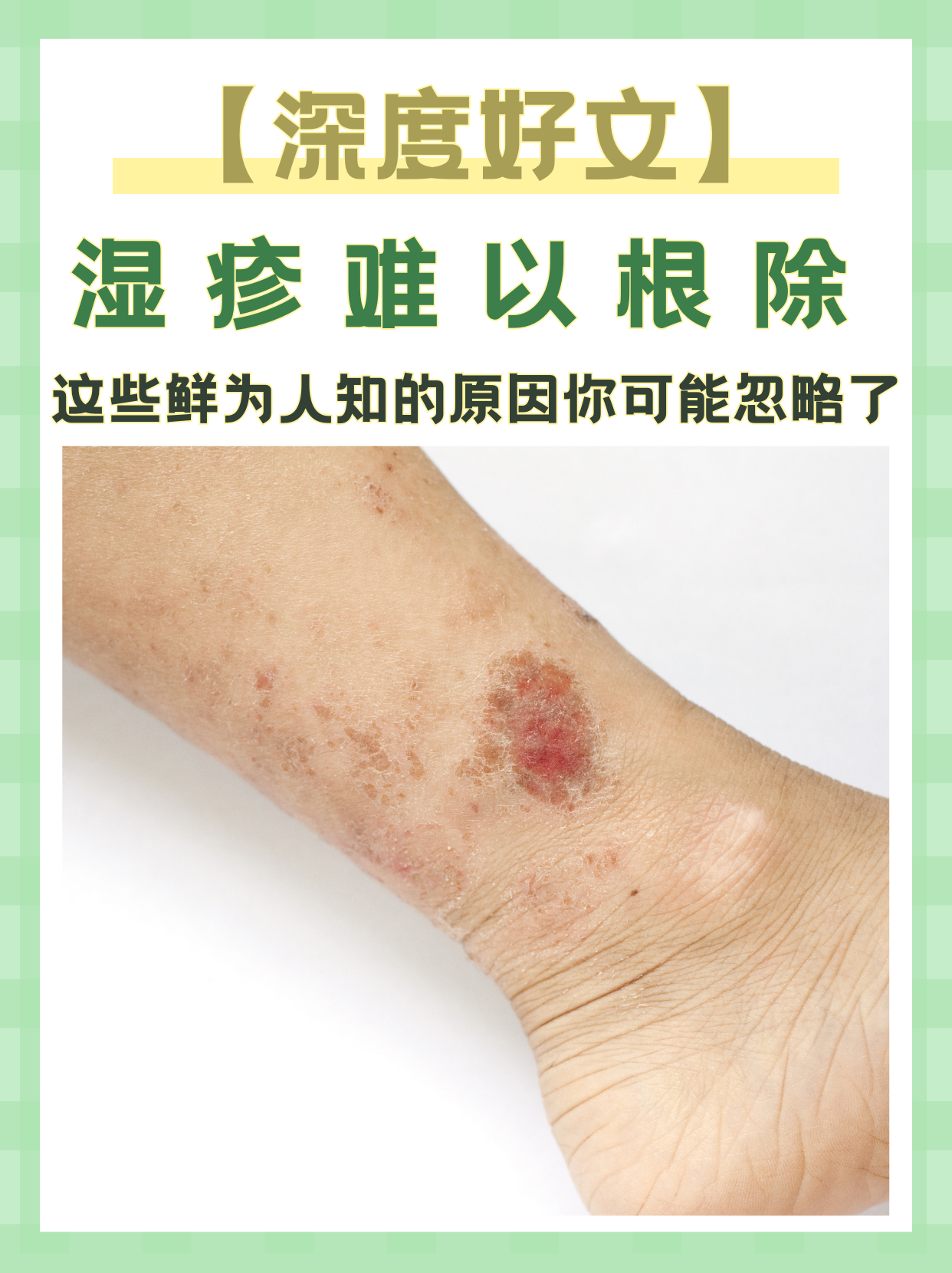 为什么皮肤好
