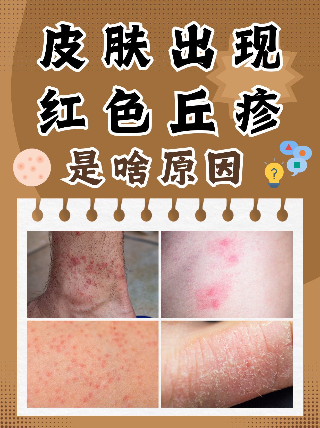 皮肤上突然冒出红色丘疹,不仅影响美观,还可能带来瘙痒,疼痛等不