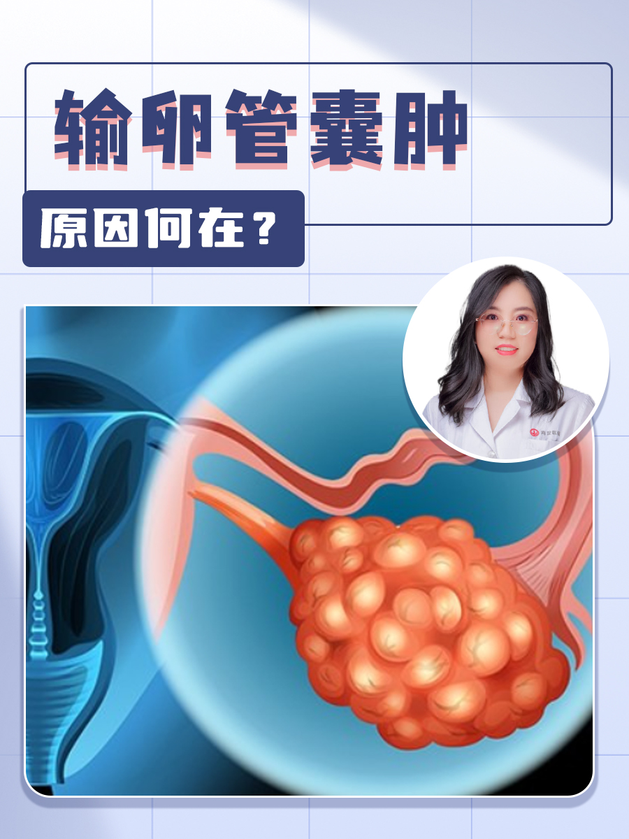 输卵管囊肿,原因何在?