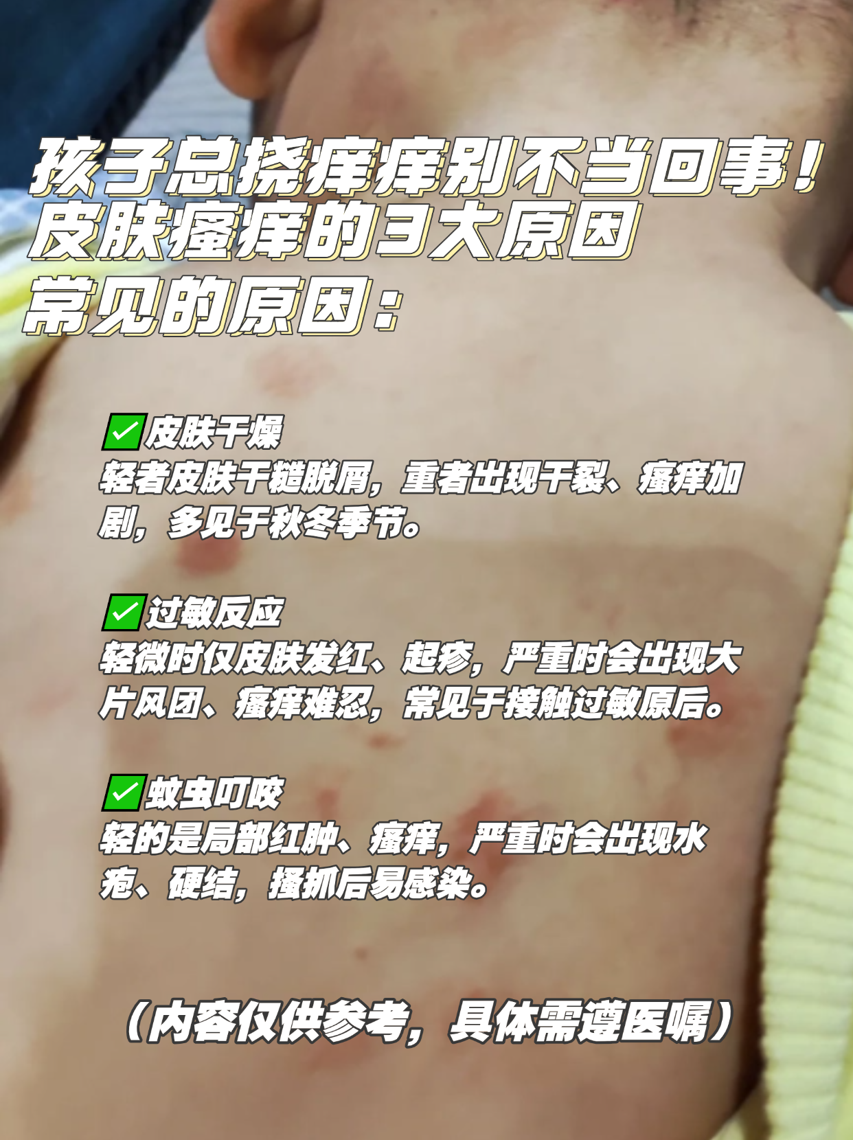 皮肤瘙痒为什么