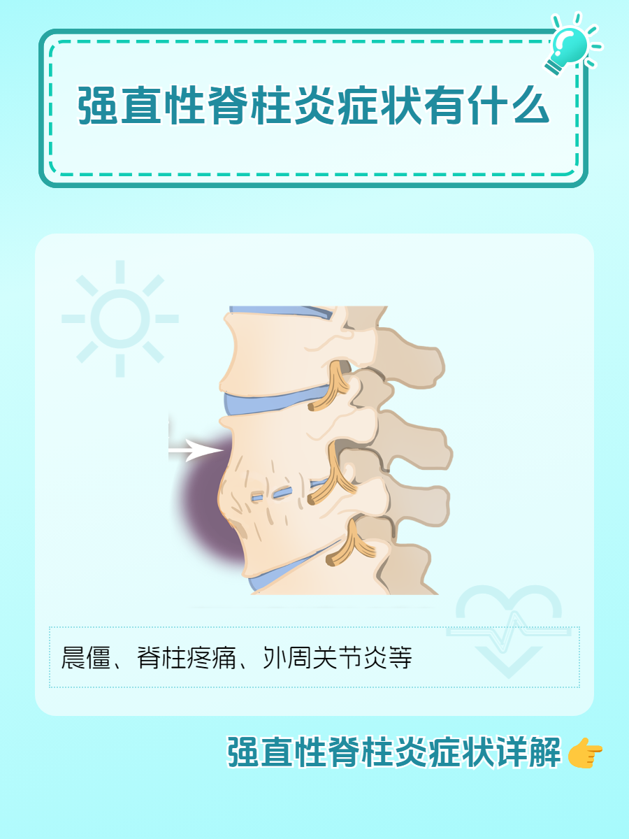 强直性脊柱炎症状有什么?