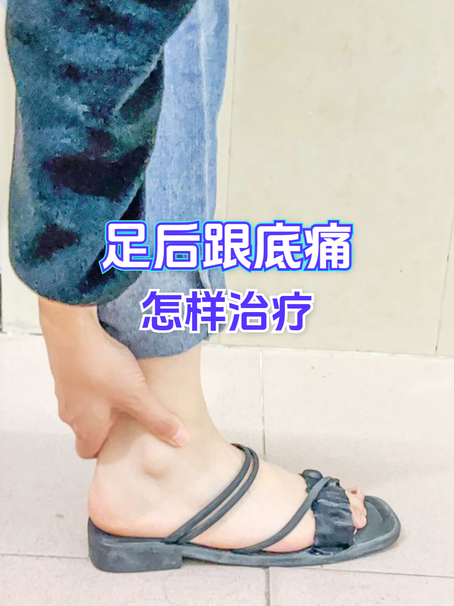 足后跟底痛是常见困扰,多因足底筋膜发炎,跟骨骨刺或足跟脂肪垫萎缩