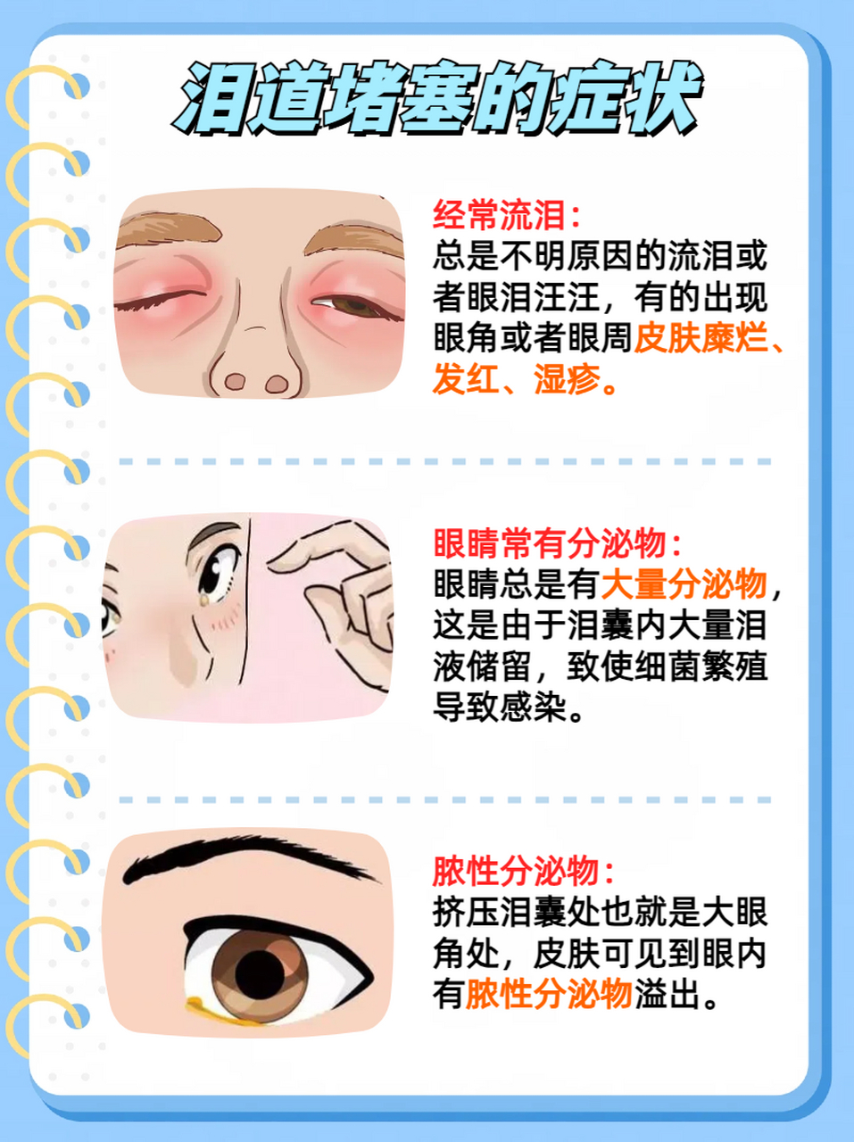 不通  小宝宝92,尤其是新生儿,眼睛分泌物过多90,大多是鼻泪管