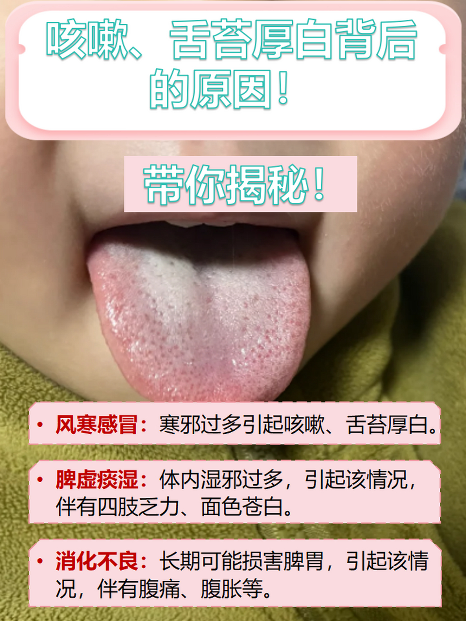 但有的朋友舌苔厚白且伴咳嗽,这究竟是什么原因引起的呢?