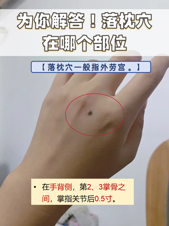 落枕穴其实是指外劳宫,它在手背侧,第2,3掌骨之间