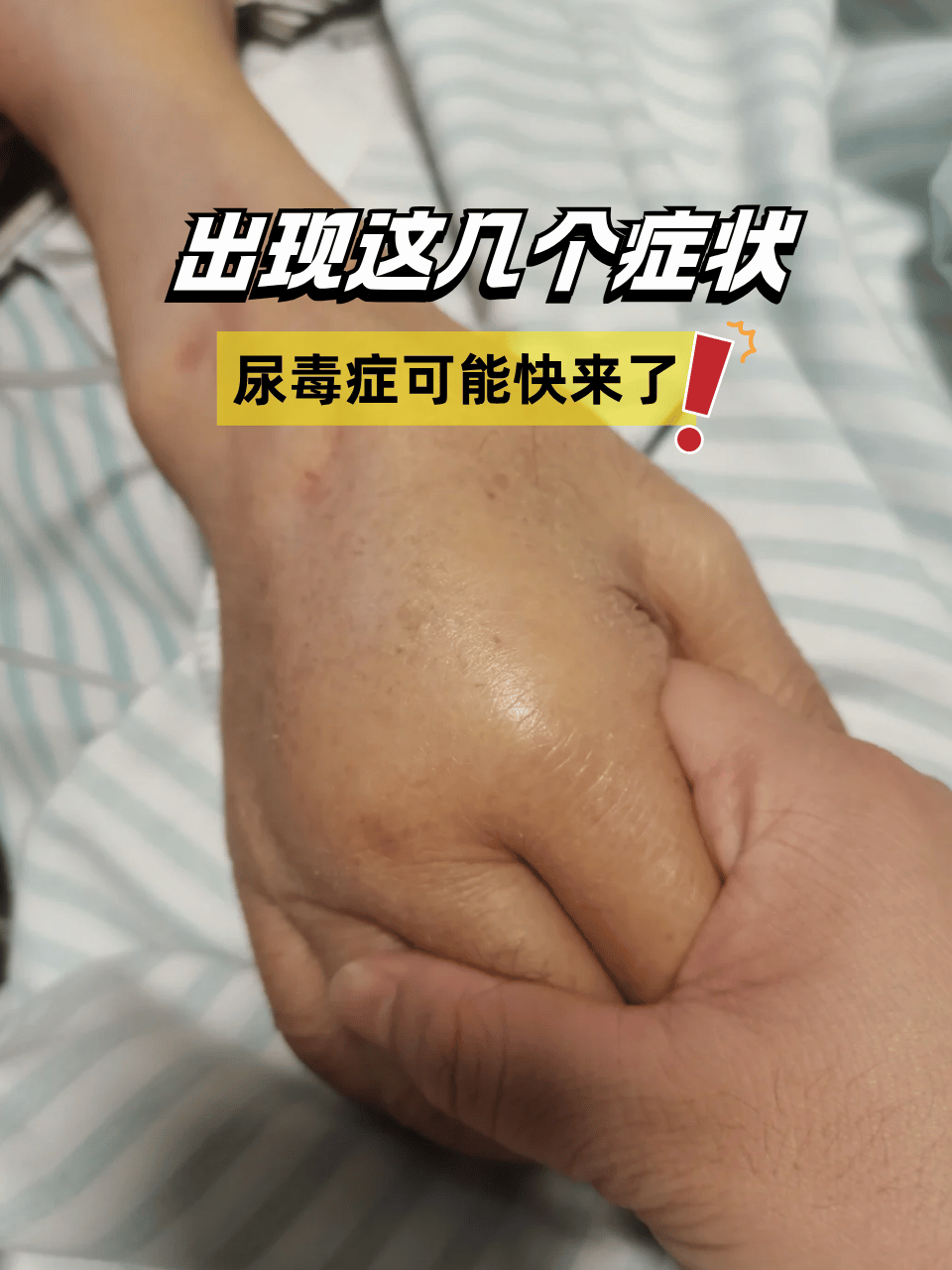 出现这几个症状,尿毒症可能快来了