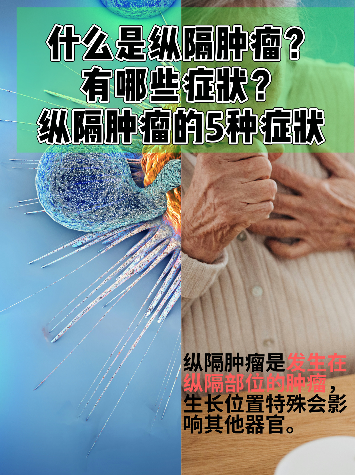 纵隔肿瘤的5种症状 人体胸腔中部的纵隔区域,容纳着众多重要器官,而
