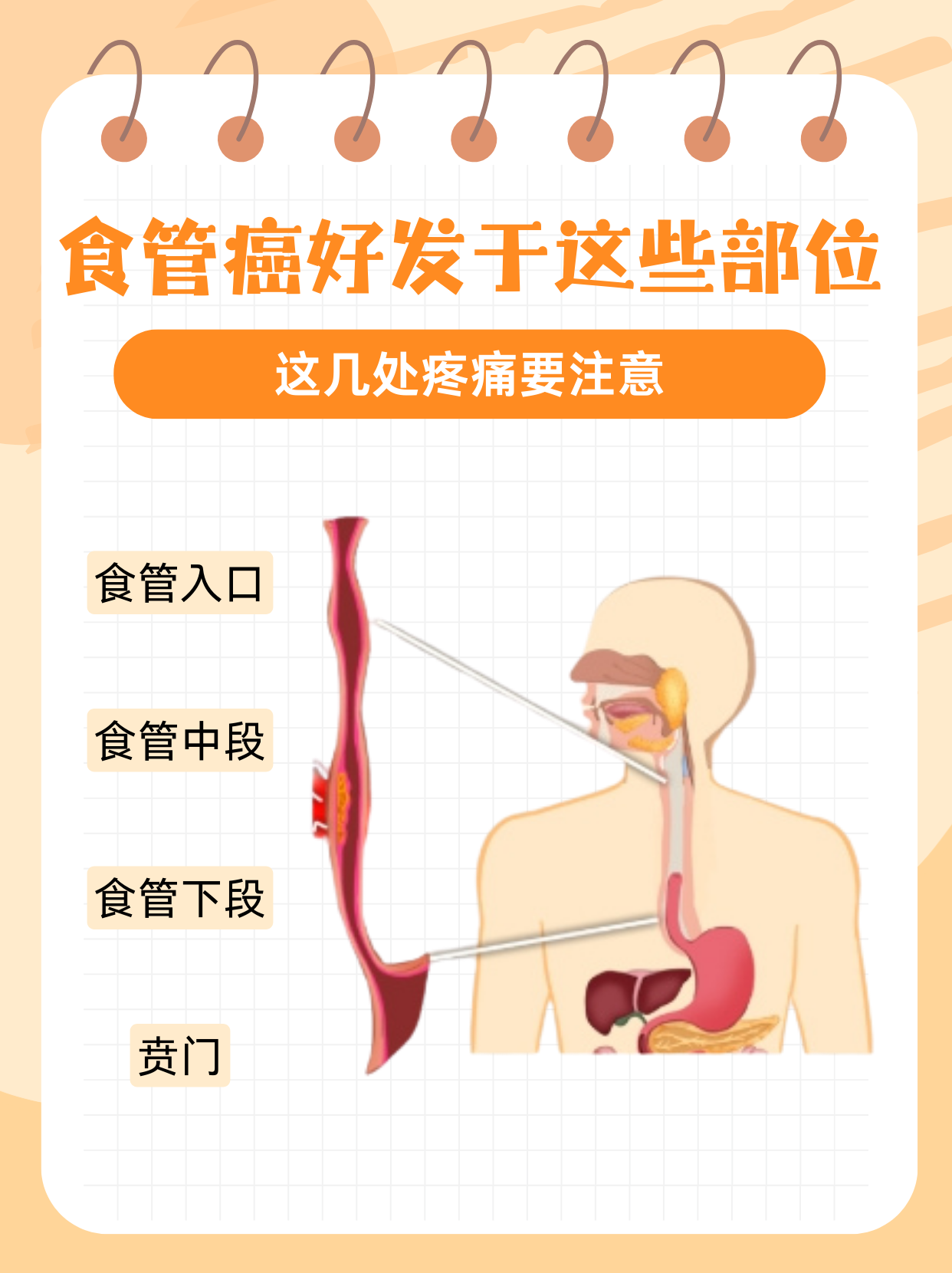和正常的食道图片食管位置图食道癌图片食管癌示意图食道癌脖子图片