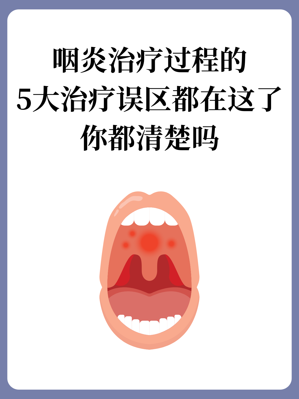  嗓子有病毒怎么治疗(嗓子疼最好的消炎药)