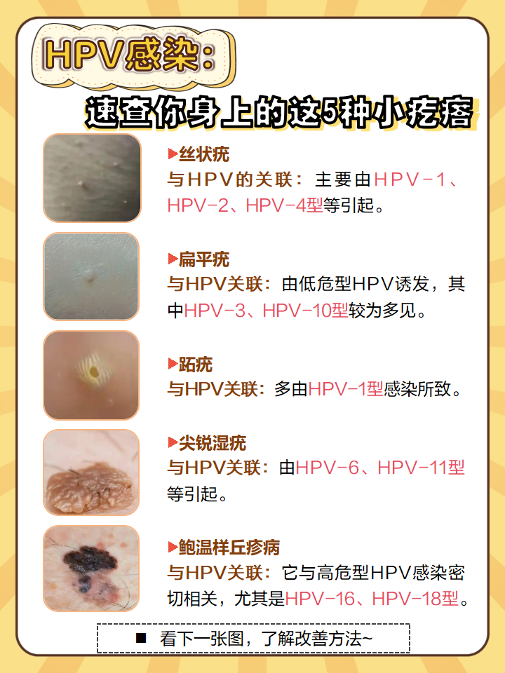 身上莫名长出5种小疙瘩,可能是hpv(人乳头瘤病毒)在作祟,快来自查一