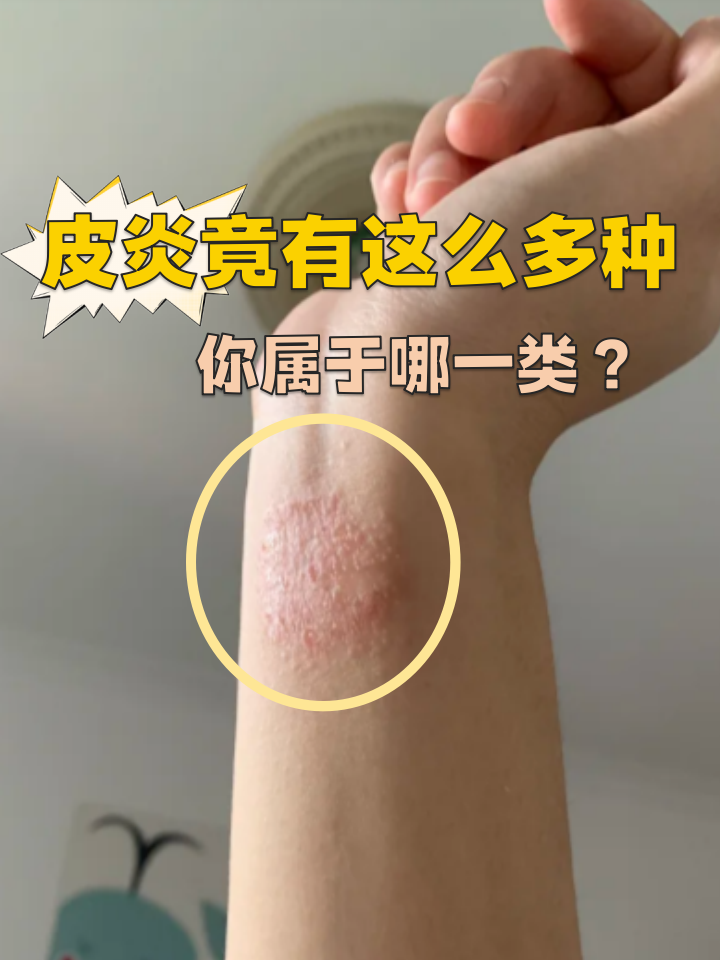 我看你是皮痒了吧