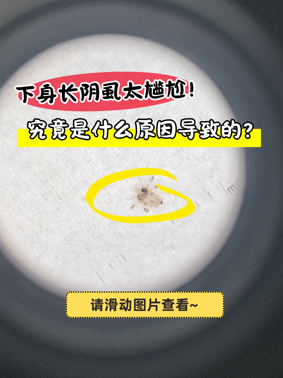 究竟是什么原因导致的?