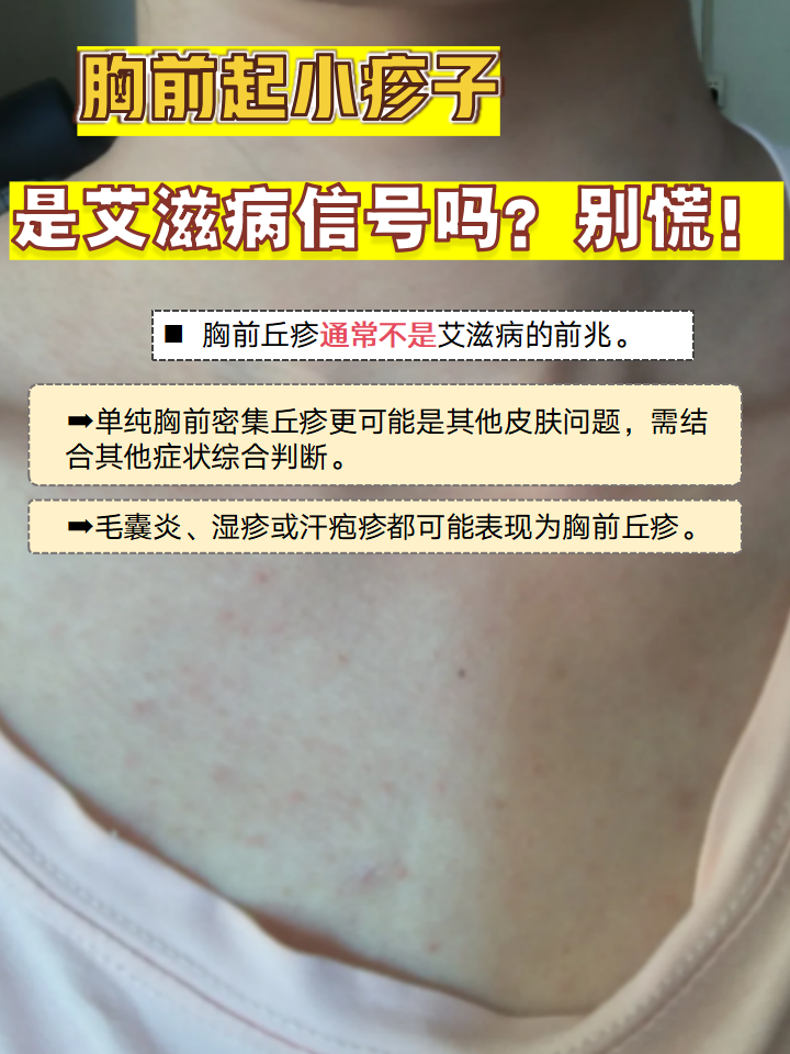 胸前起小疹子,是艾滋病信号吗?别慌!