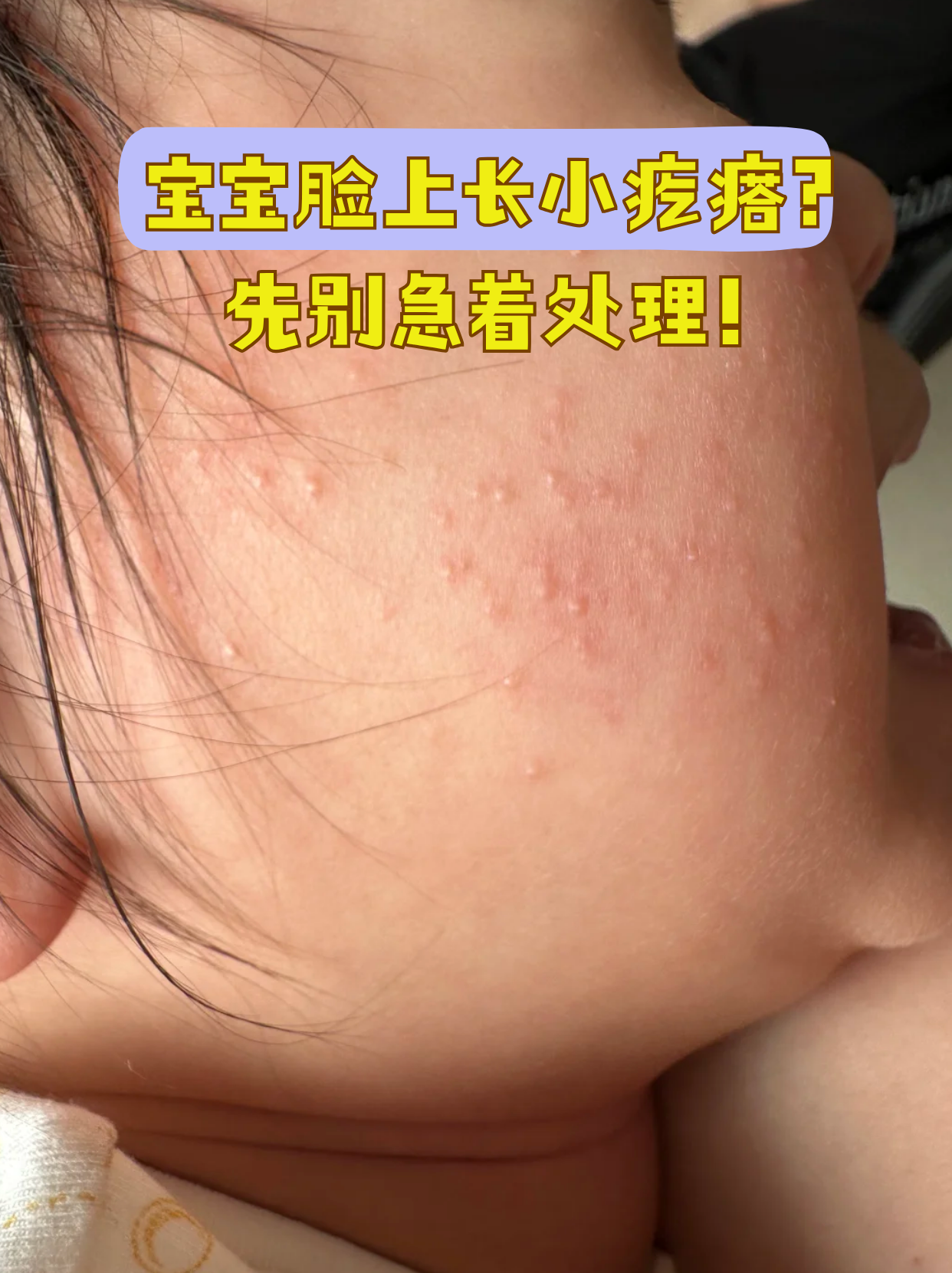 为什么脸上有很多小疙瘩