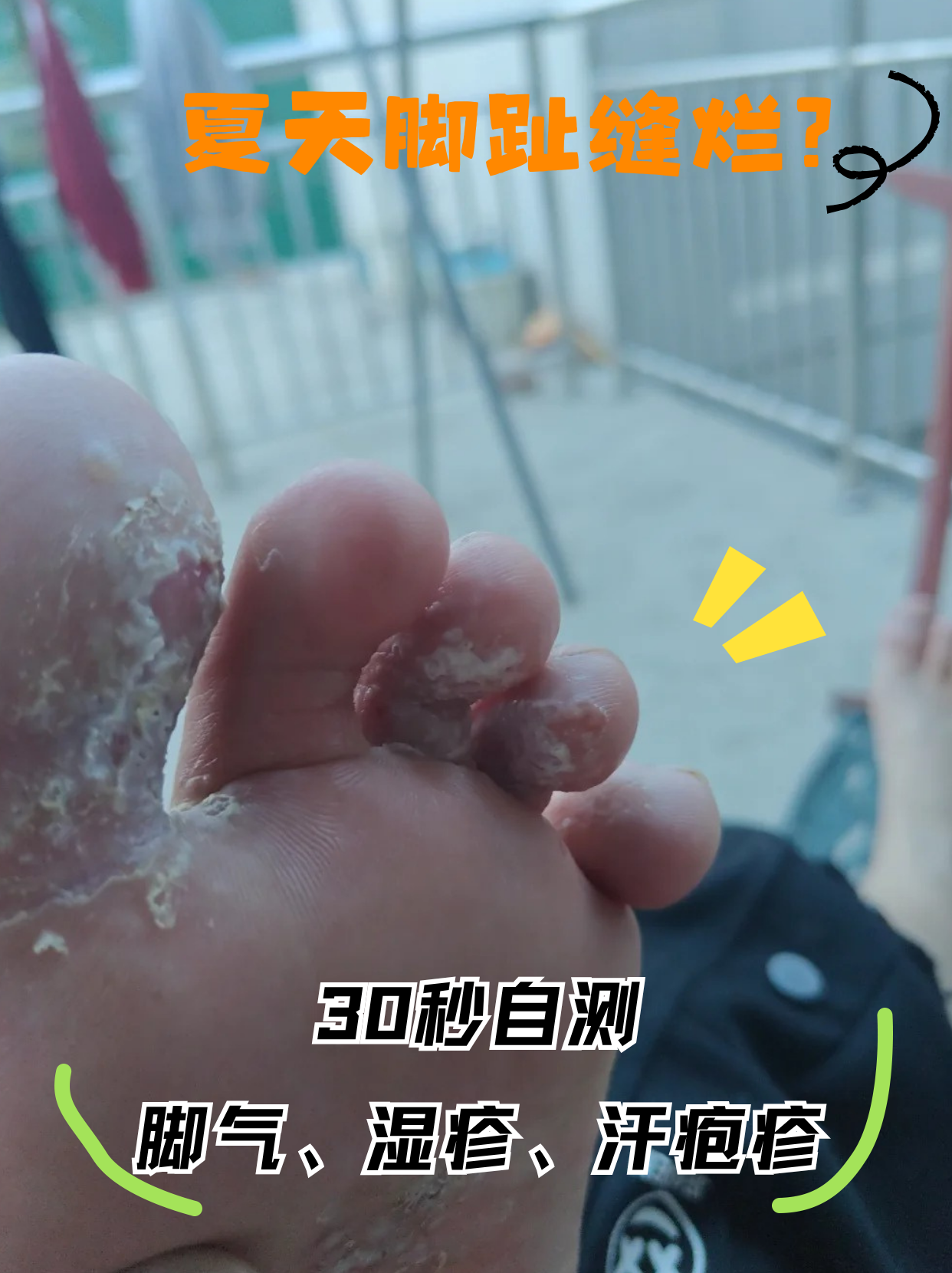 一张图教你分清三种常见脚病,对症处理才有效!
