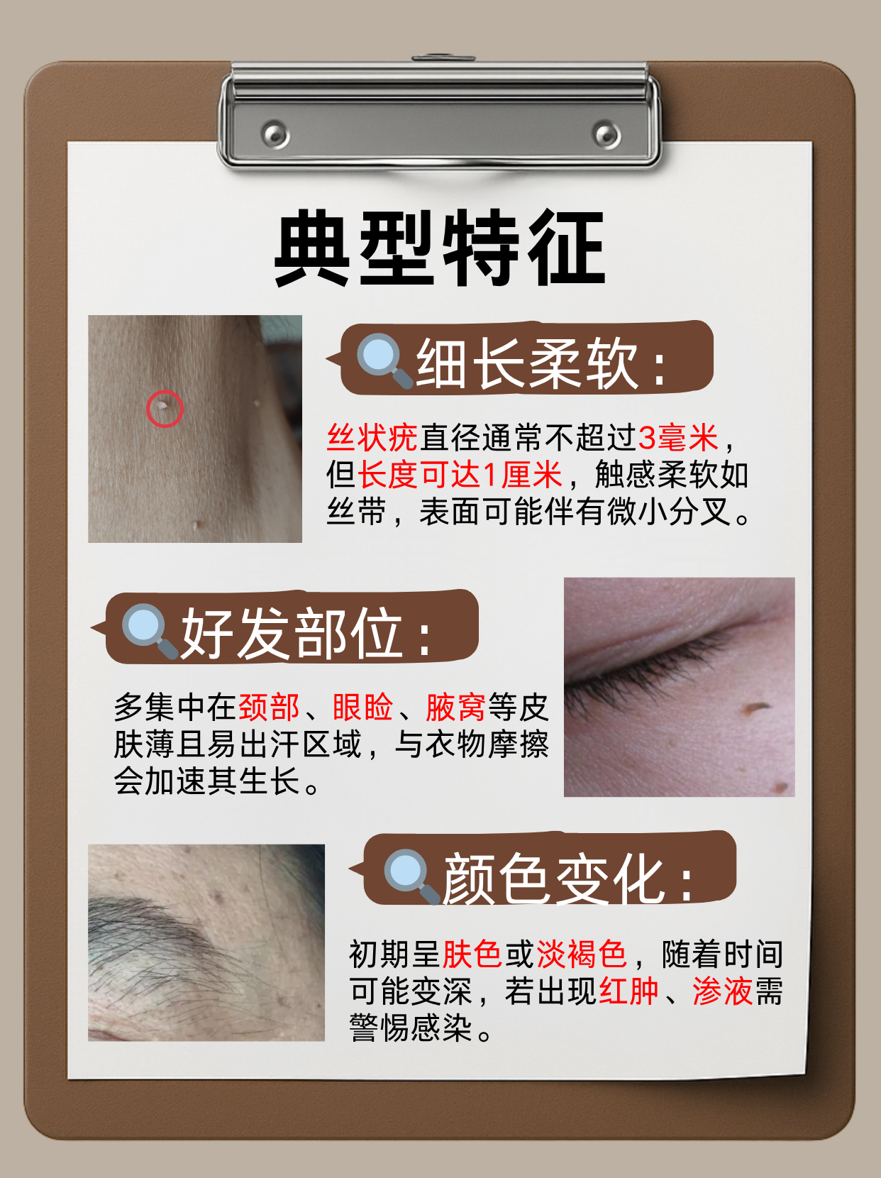 为什么长丝状疣