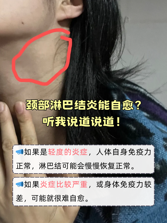 脖子为什么会长淋巴结