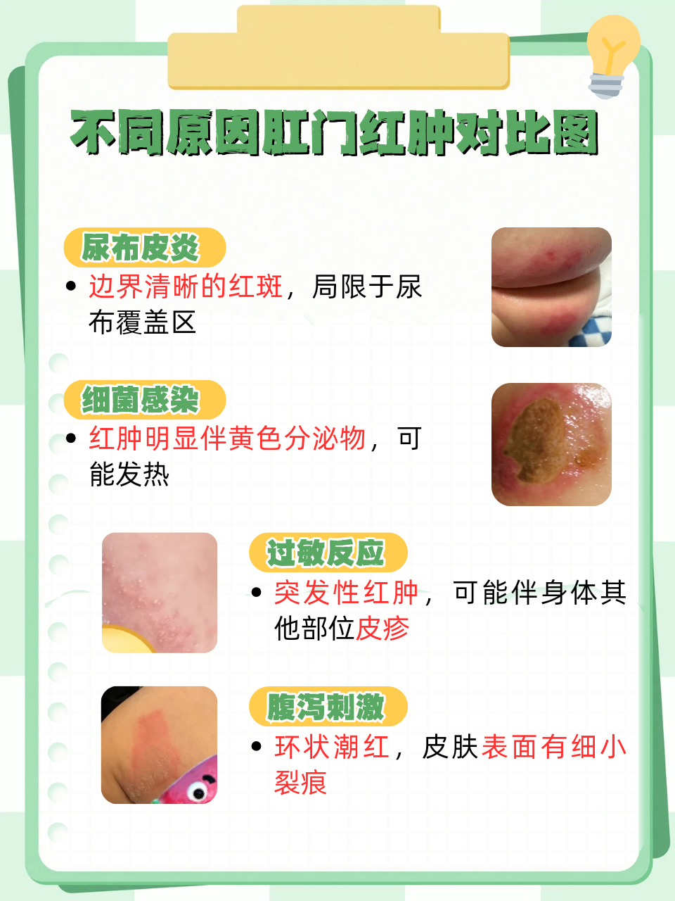 发现宝宝肛门红肿,新手爸妈常常心急如焚