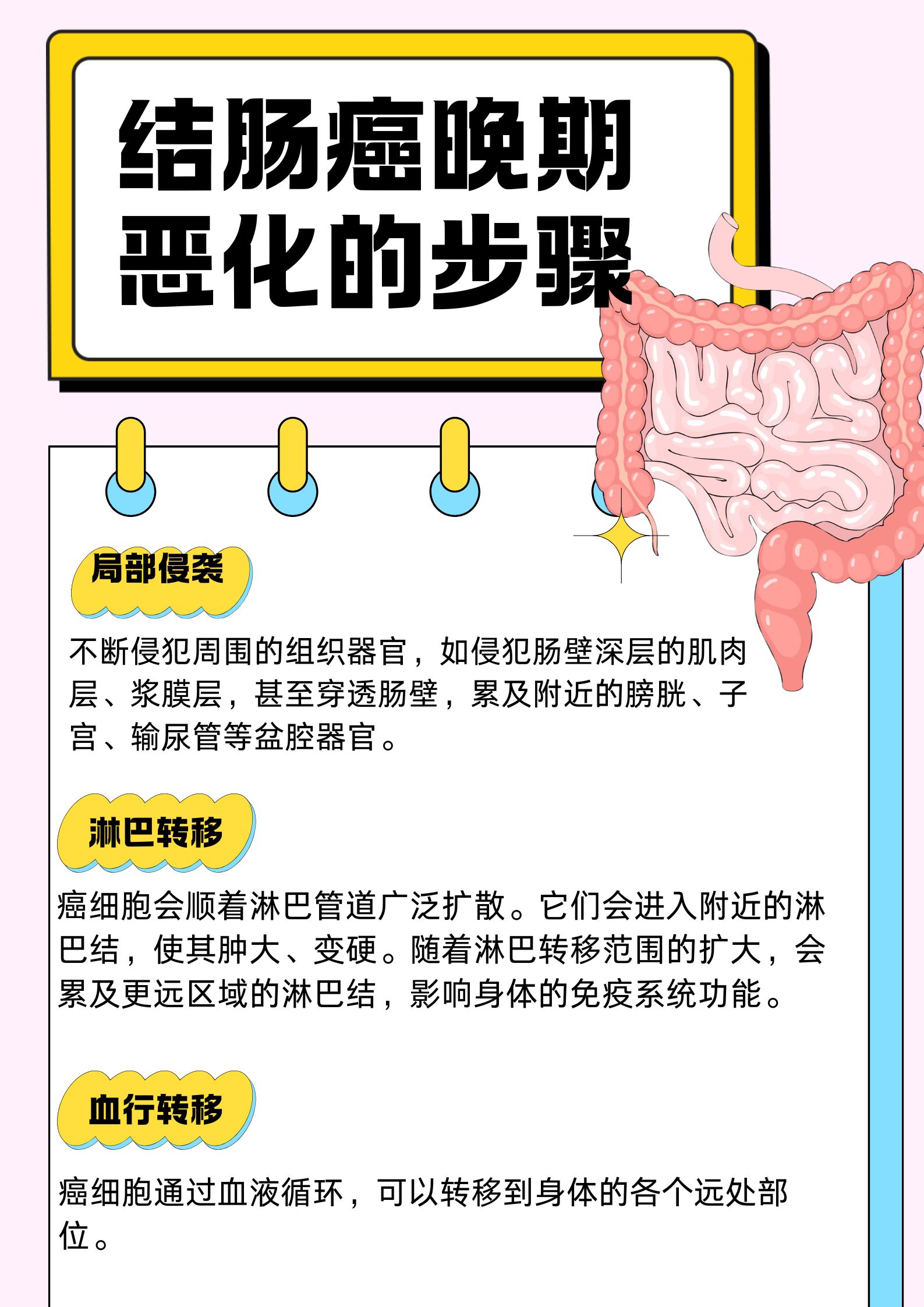 结肠癌晚期恶化的步骤