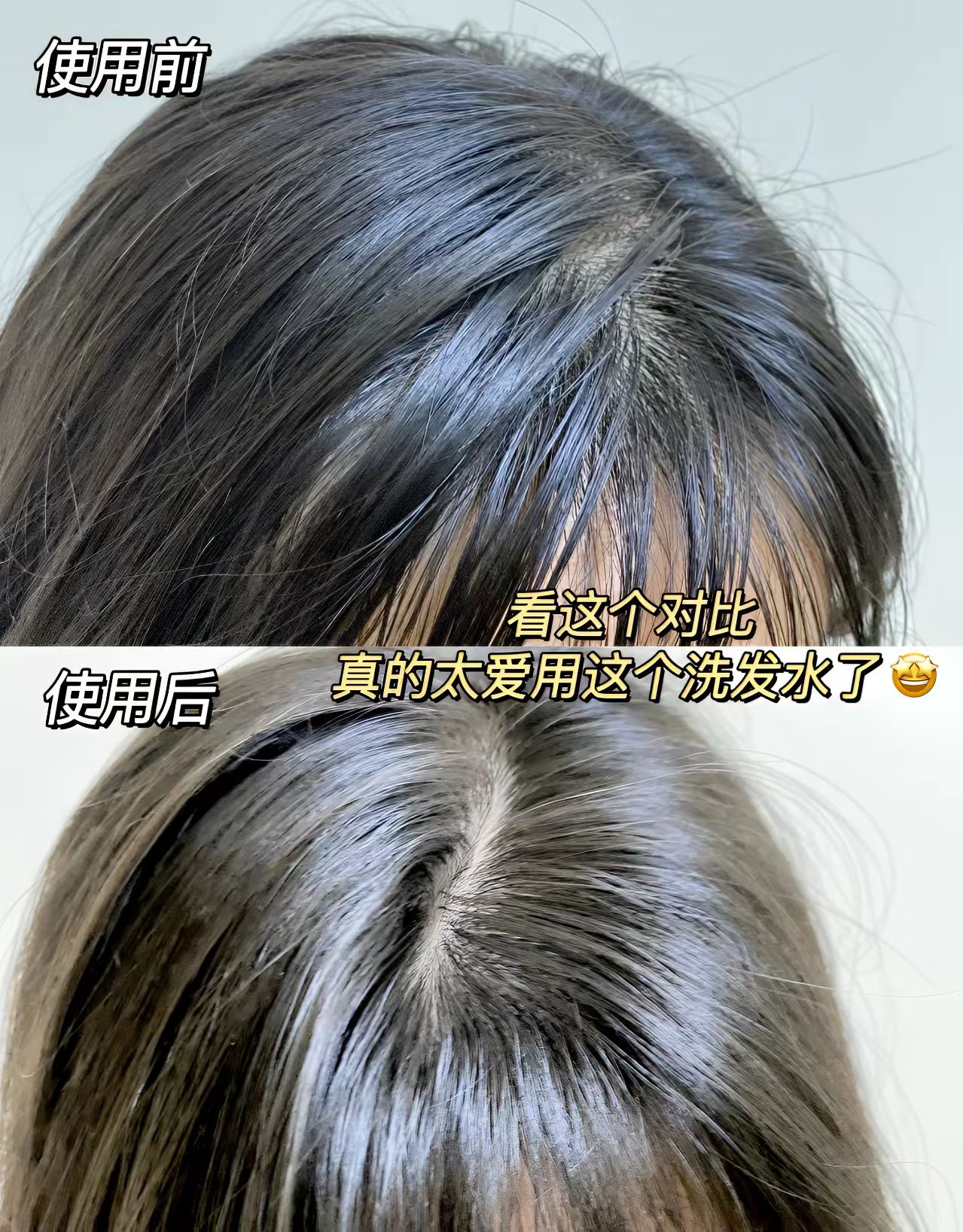 使用体验   蜂花控油蓬松洗发水简直是油头星人的救星