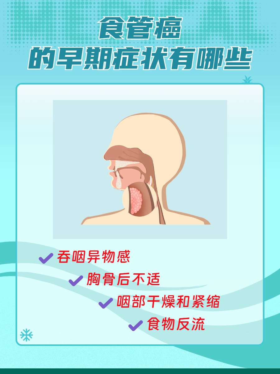 食管癌早期症状有哪些?