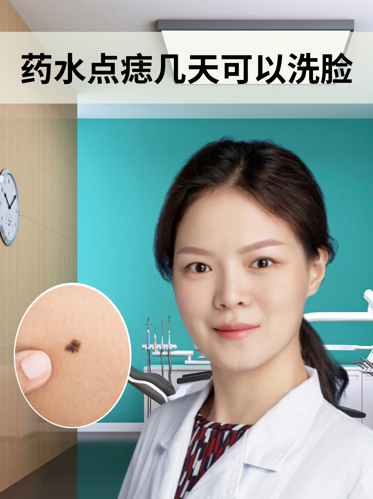 药水点痣几天可以洗脸 药水点痣后几天可以洗脸,这个问题并没有一个