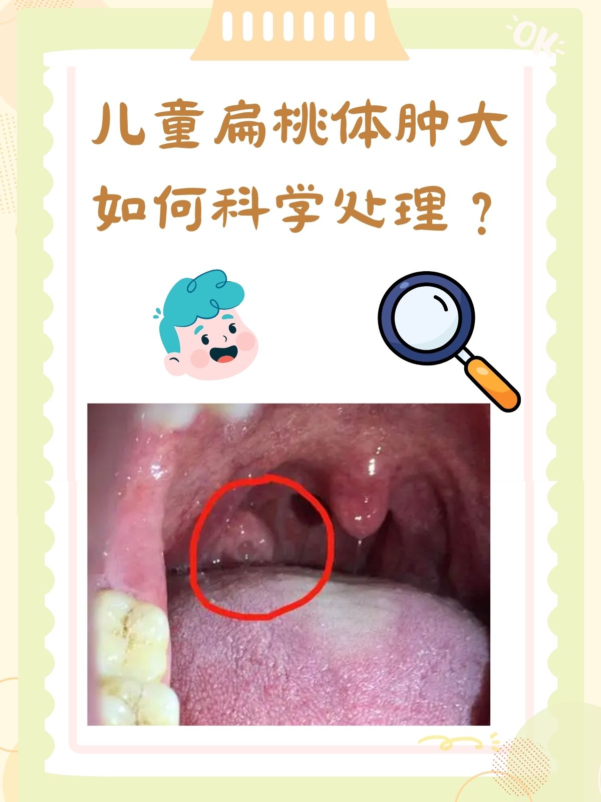 儿童扁桃体肿大如何科学处理?