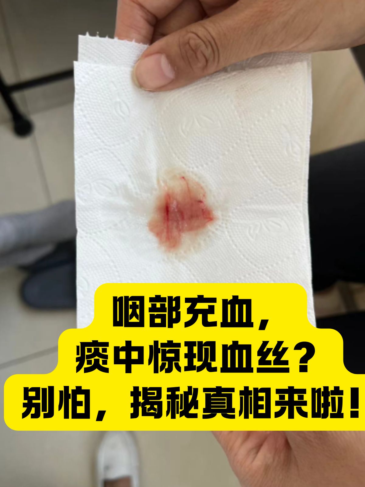 咽部充血,痰中惊现血丝?别怕,揭秘真相来啦!