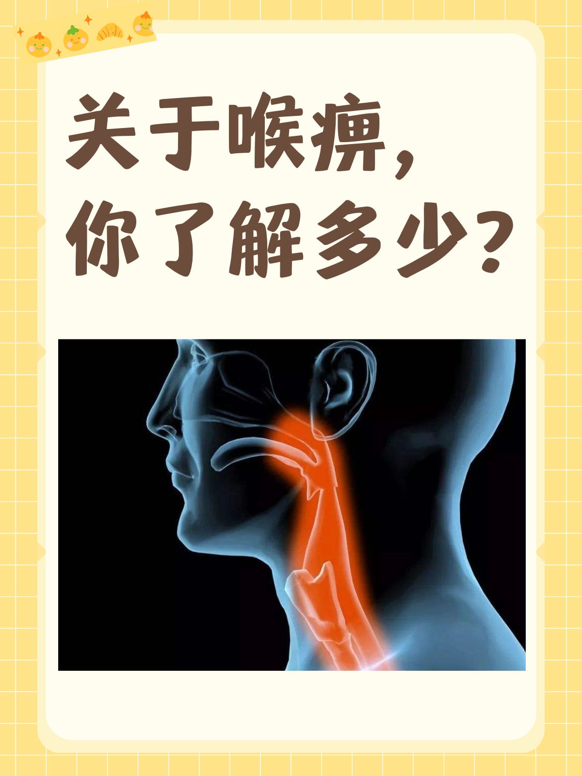 在门诊中常常会遇到一些患者被咽喉不适所困扰