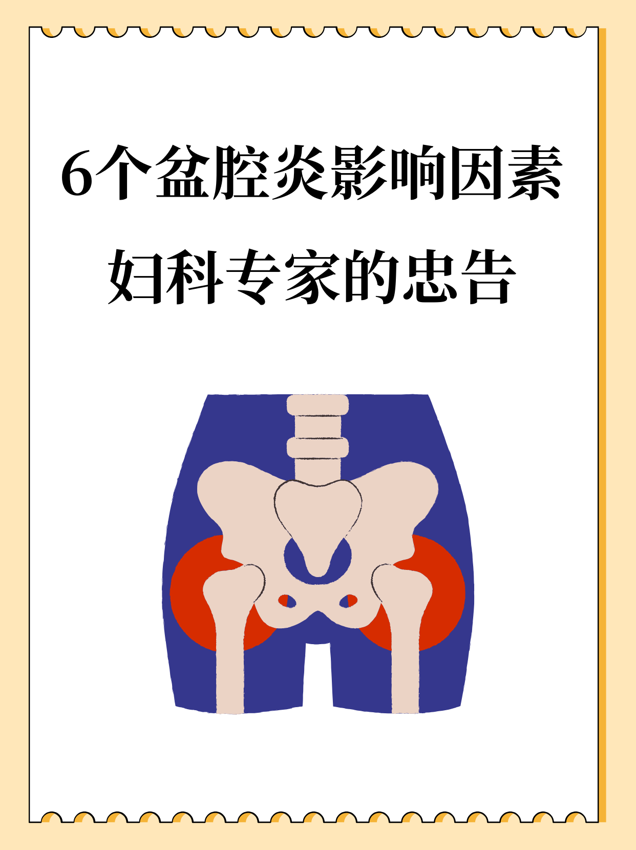 盆腔炎因为什么引起的 盆腔炎因为什么引起的