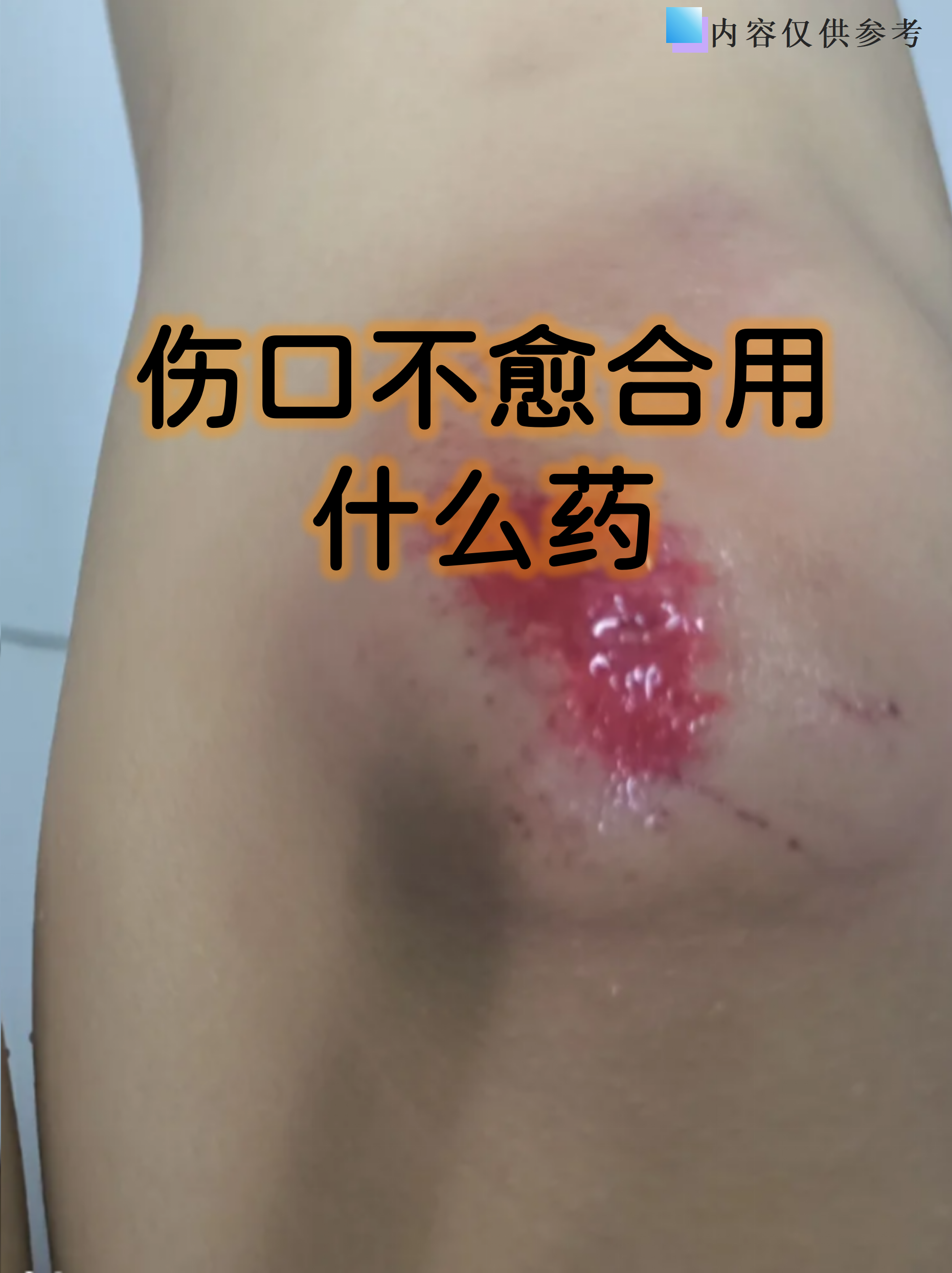 伤口不愈合用什么药