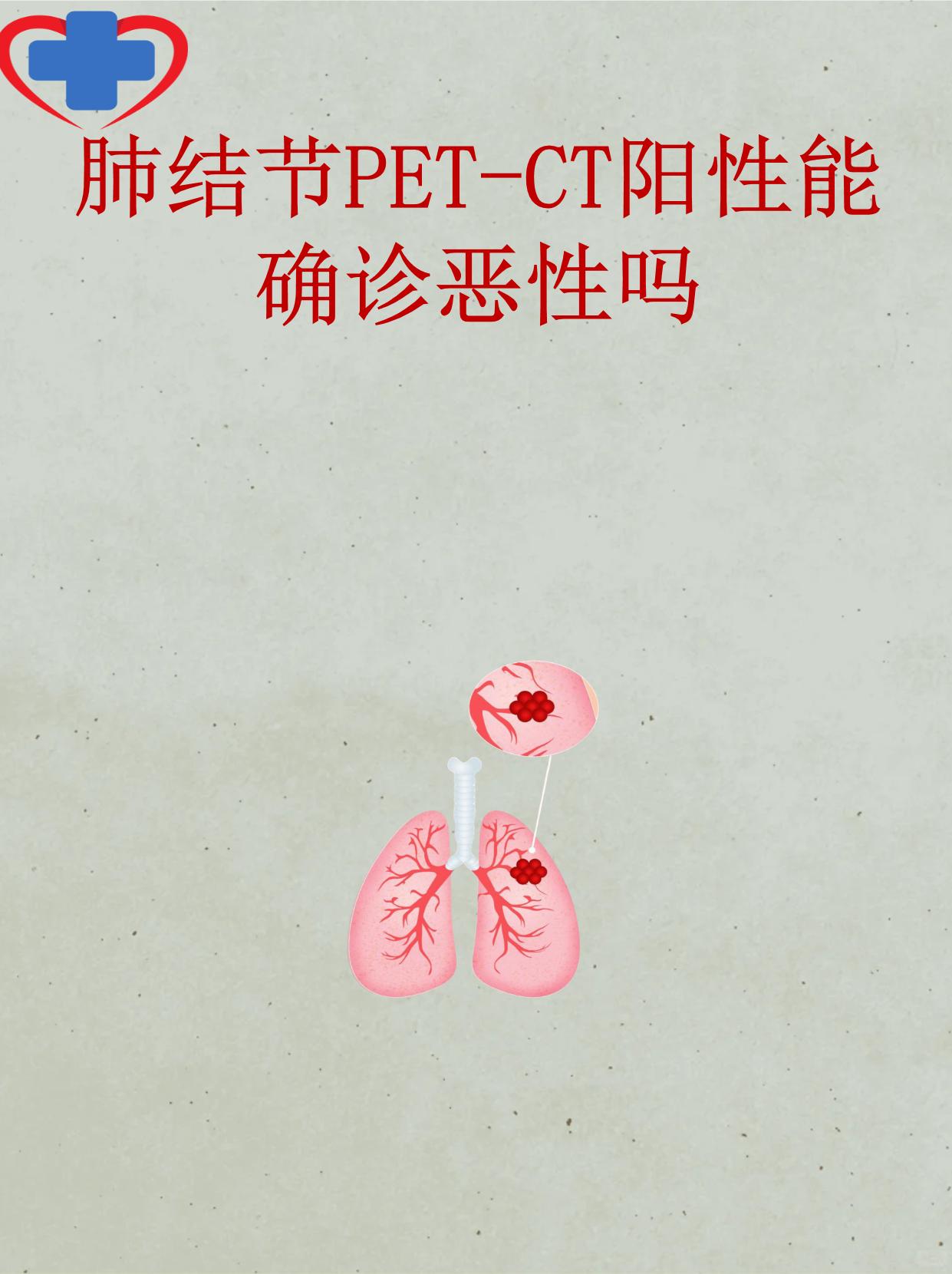 ct阳性时很多人会担心是否意味着恶性肿瘤