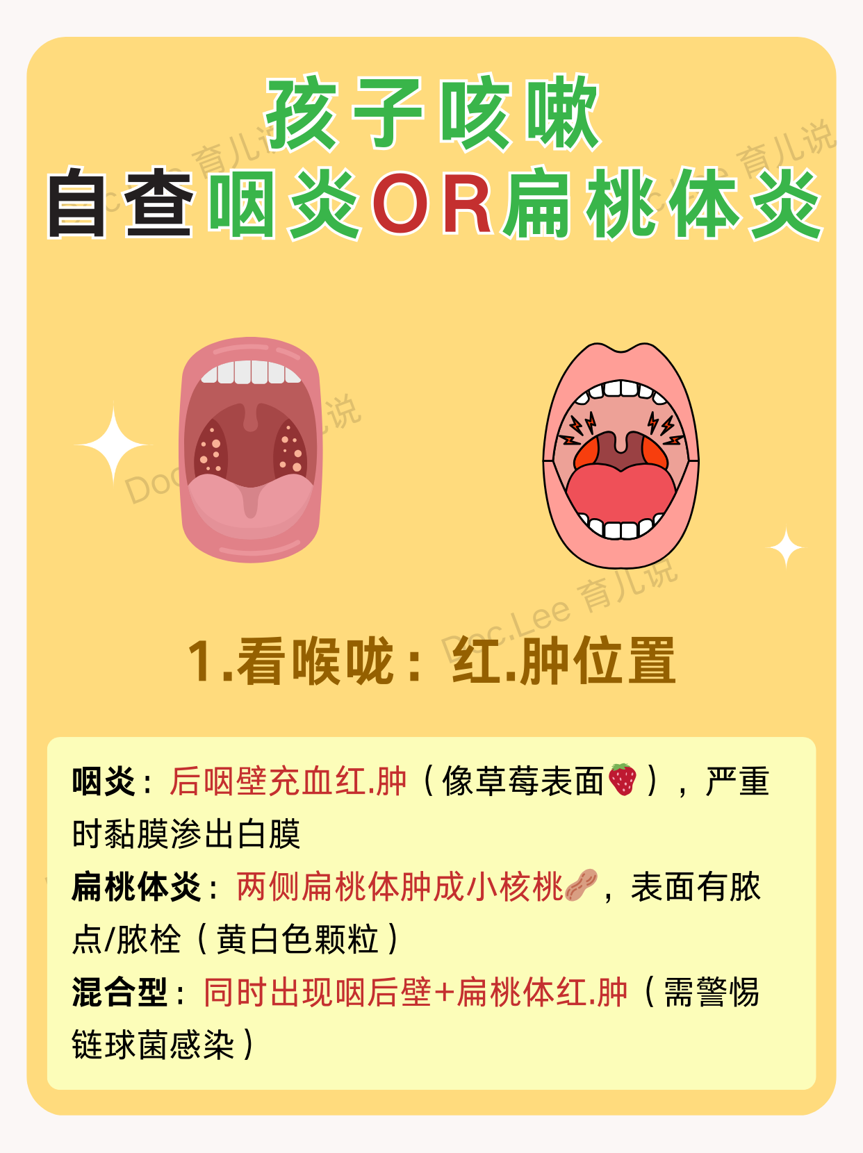  什么病毒嗓子疼不发烧不咳嗽(什么病毒嗓子疼不发烧不咳嗽呢)