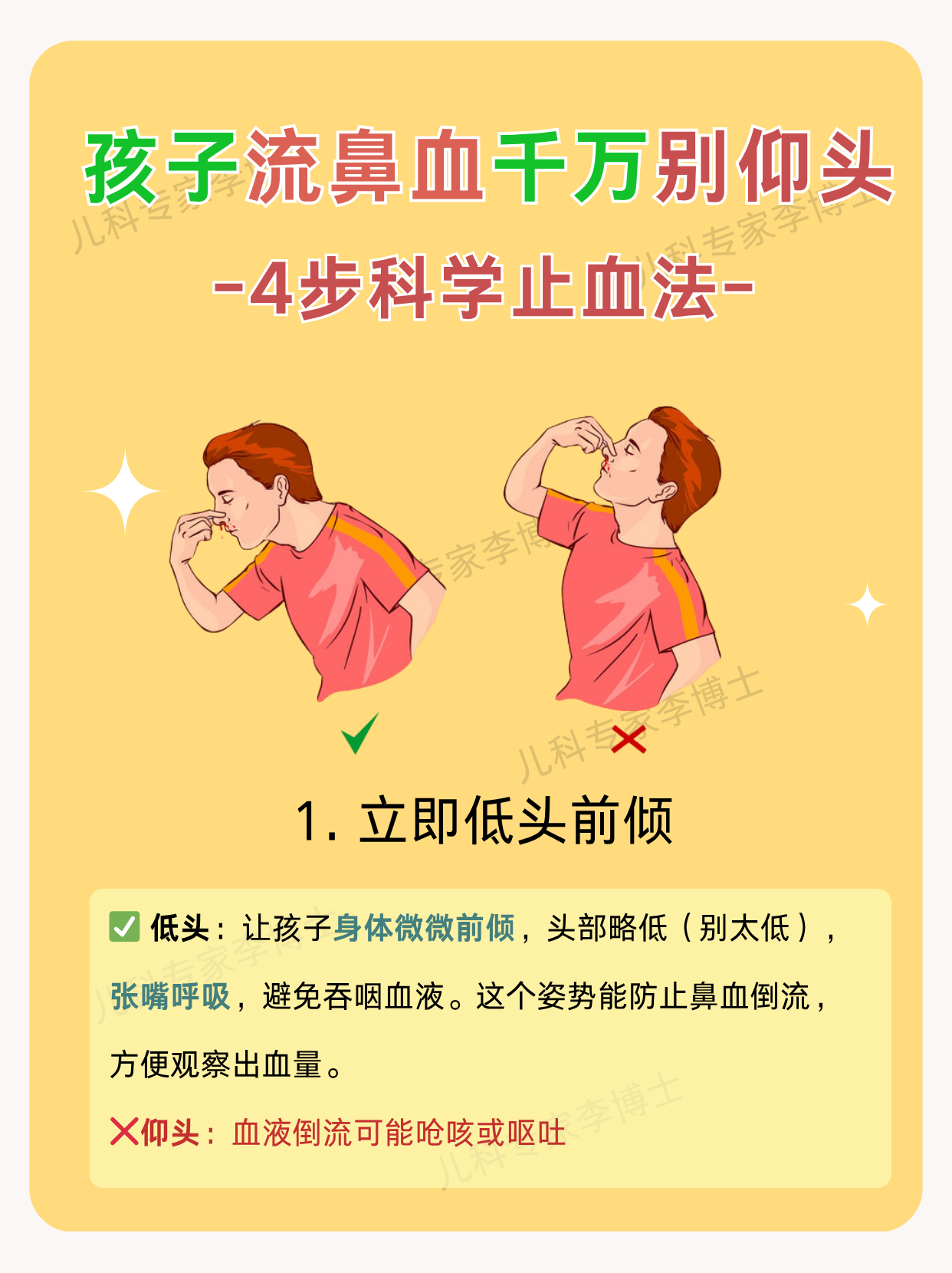 孩子流鼻血千万不要仰头,四步快速止血