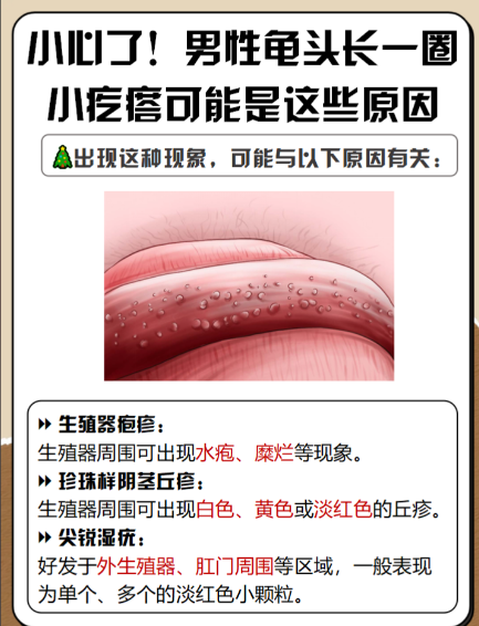 冠状沟一圈红肿,可能是清洁不到位,污垢刺激引起