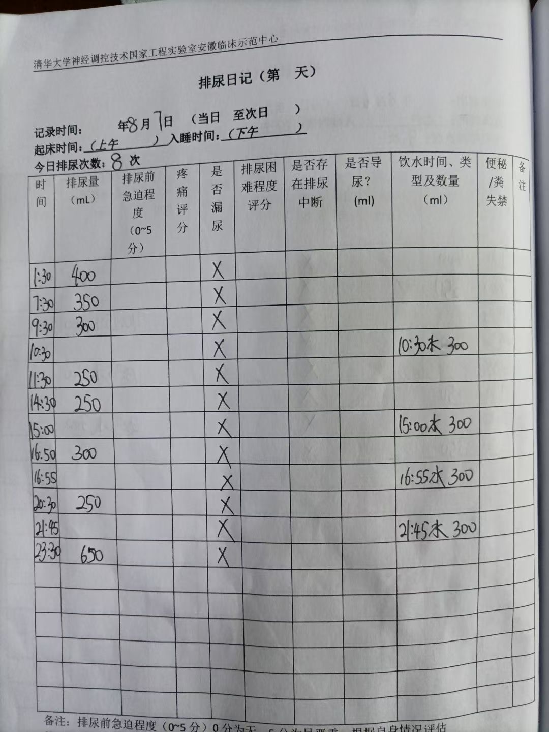81岁老人"尿不出来",植入"膀胱起搏器"解决排尿困难!