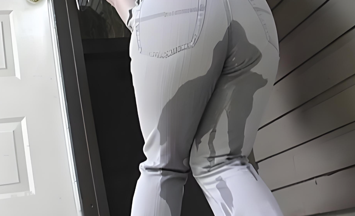 辽宁63岁阿姨尿失禁,鼓起勇气尝试骶神经调控,结果和想象的完全不一样