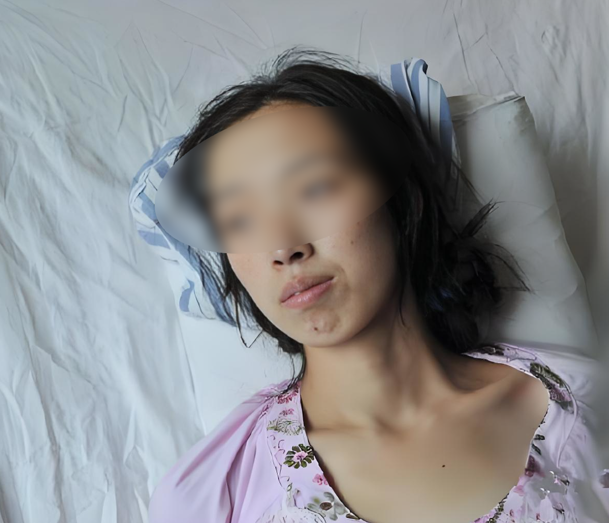  新冠肺炎后遗症有多恐怖(新冠肺炎后遗症都有啥)