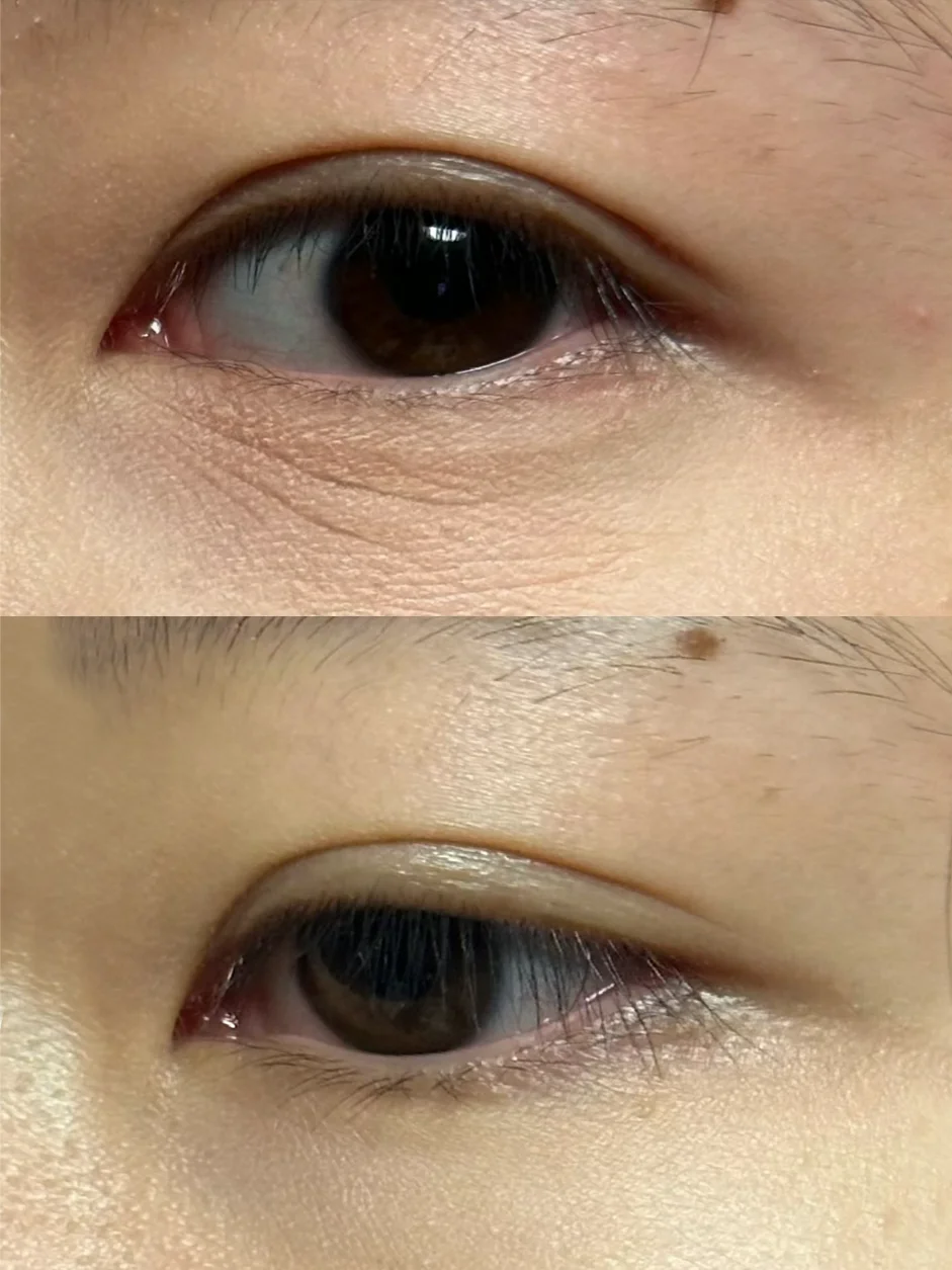 巨巨巨牛的眼霜 看似平平无奇,坚持一段时间,没想到眼纹真的有所改善!
