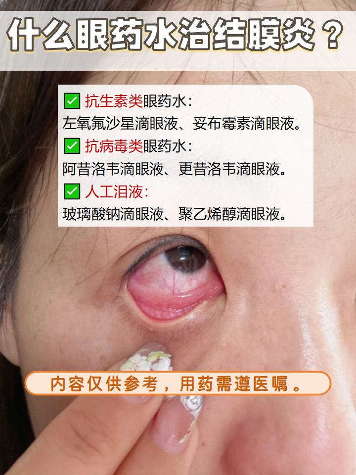 结膜炎俗称"红眼病",它通常是由微生物感染,外界刺激,过敏等引起的