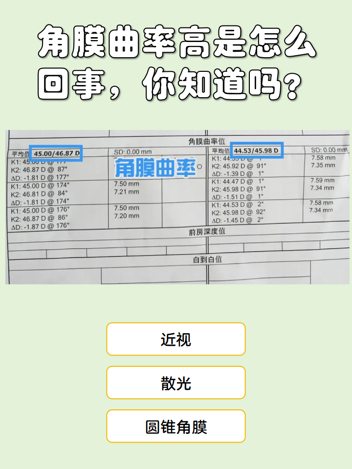 是角膜的屈光度或曲率半径值,常用于判断有无散光及散光性质